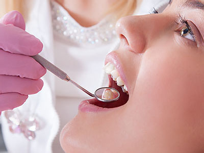 Fillings at Lake City Family Dental Care in Lake City, FL
