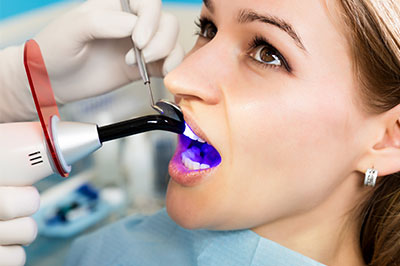 Lake City Family Dental Center | Snoring Appliances, Extractions and Dental Fillings