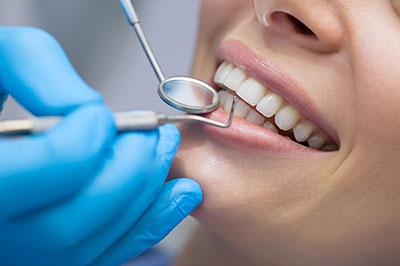 Lake City Family Dental Center | Extractions, Dental Cleanings and Snoring Appliances