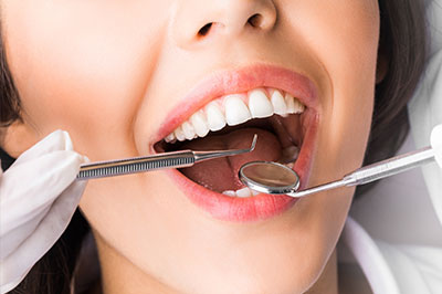 Lake City Family Dental Center | Teeth Whitening, Dental Fillings and Sleep Apnea