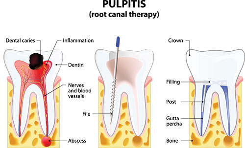 Lake City Family Dental Center | Cosmetic Dentistry, Ceramic Crowns and Sleep Apnea